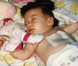 First surgery at 3 months old...1991